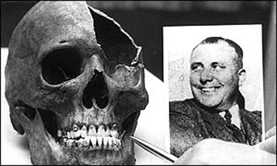 Alleged Skull of Martin Bormann and Bormann Photo